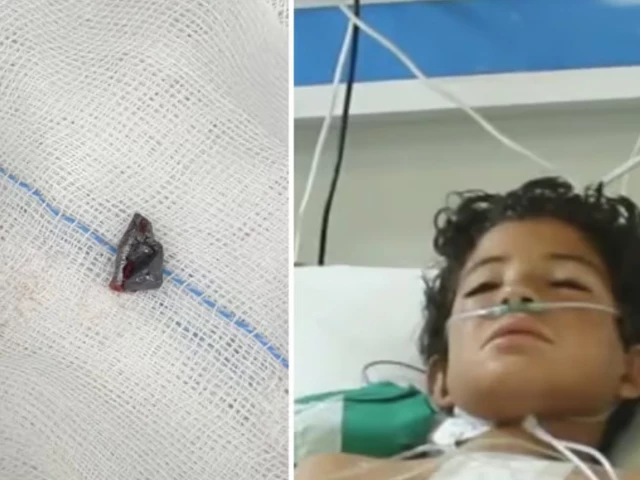 این آئی سی وی ڈی کراچی میں بچوں کے قلبی آپریشن تھیٹر